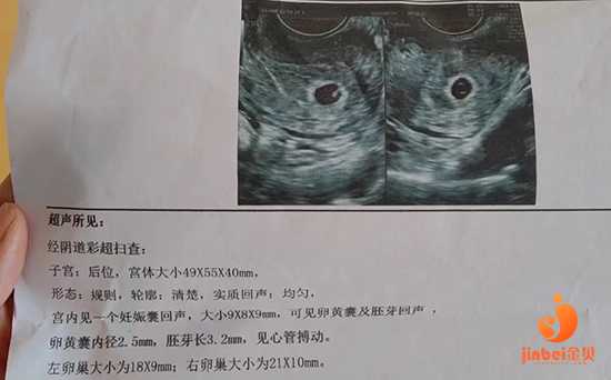 代孕中心招供卵_2023
我想代孕,输卵管发育不全会有哪些危害？能做试管婴儿吗