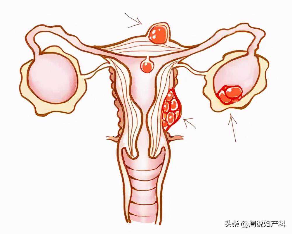 月经期的子宫内膜厚度多少正常
